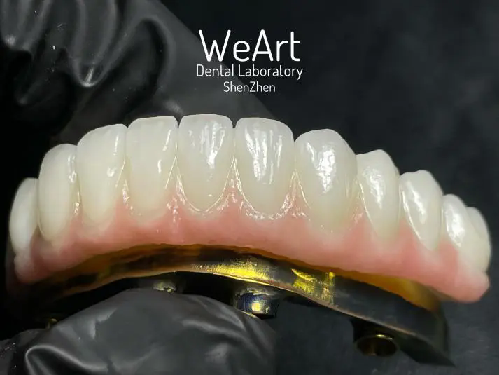 What Makes Implant Restoration the Future of Dental Health?