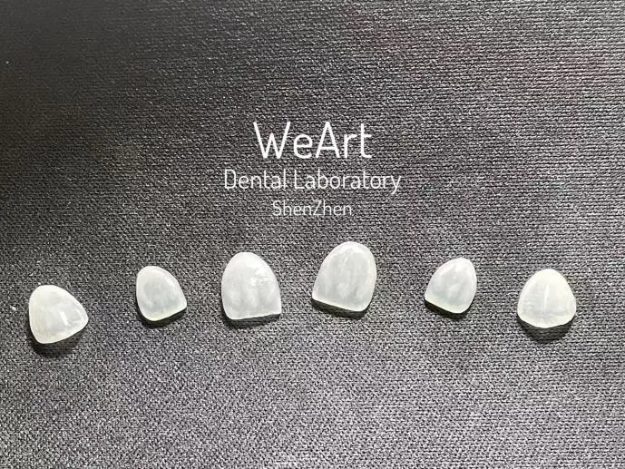 Can Feldspathic Veneers Be Repaired If They Chip Or Crack