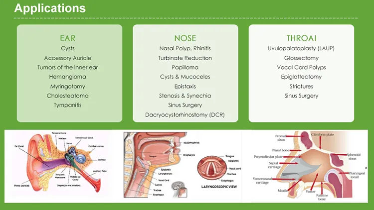 980nm Ent Laser for Endo Nasalsurgery Stenosis & Synechia Ent Ear Nose Throat Laser Device