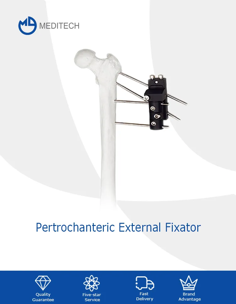 CE&ISO Certificated Orthopedic Surgical Instruments Hip Joint Traction External Fixator for Fracture Surgery