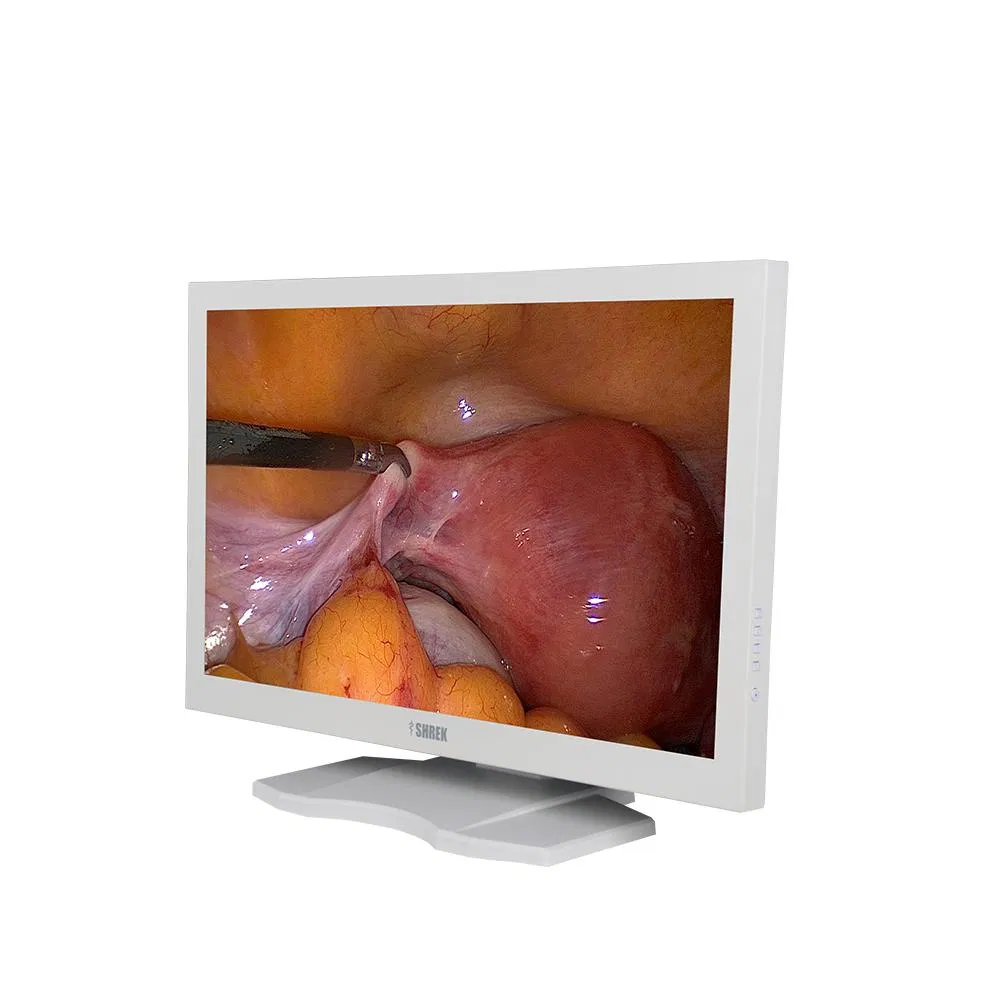 HD 1080P Video Endoscopic Camera System for Medical and Veterinary Surgery