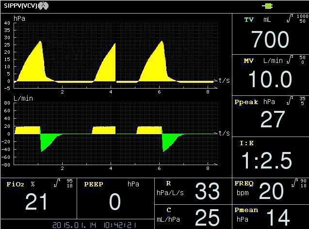 Lung Ventilator Machine, Hospital ICU Patient Ventilator PA-900b