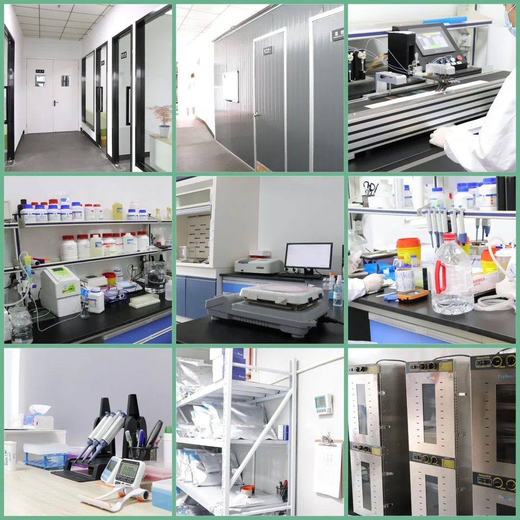 Newcastle Disease Virus Antigen Rapid Test Veterinary