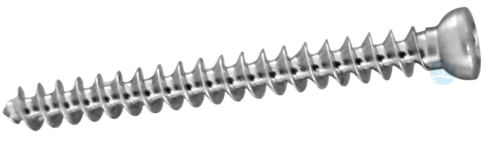 Orthopedic Distal Radius Back Plate