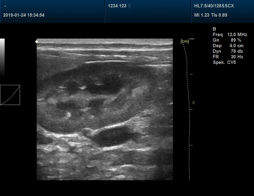 Pet Clinic Veterinary Color Doppler Ultrasound Scanner 3D, 4D