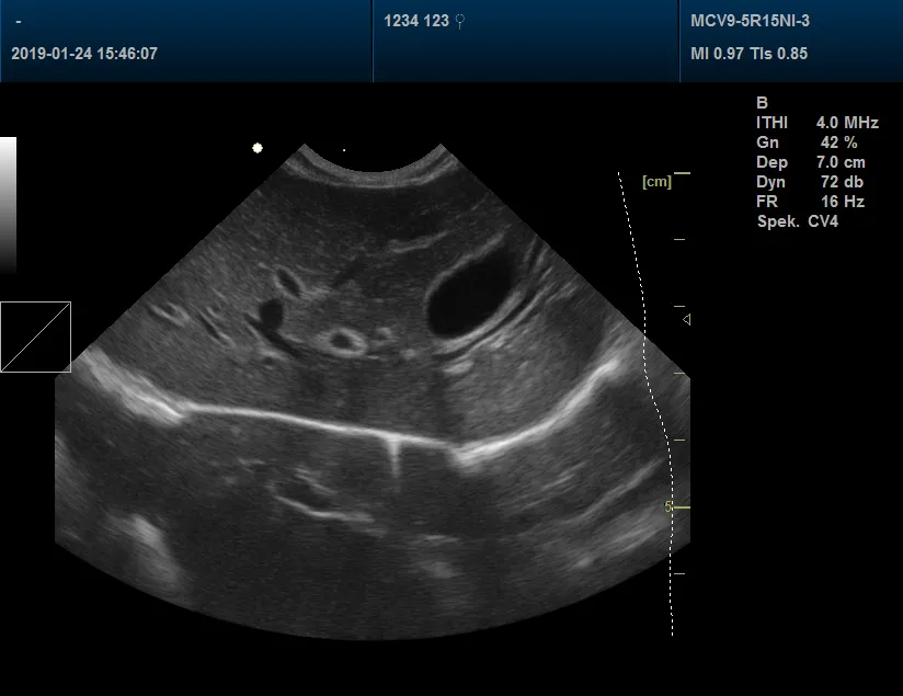 Pet Clinic Veterinary Color Doppler Ultrasound Scanner 3D, 4D