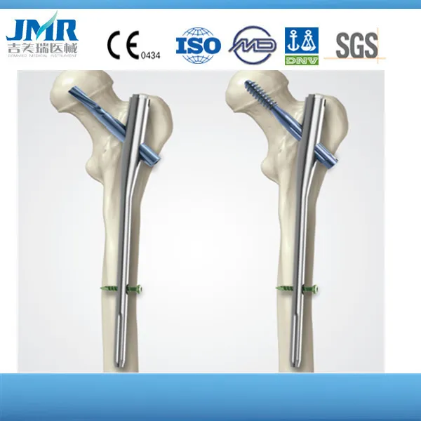 Titanium Orthopedic Implant Trauma Bone Plate Pfna Proximal Femoral Intramedullary Nail Antirotation