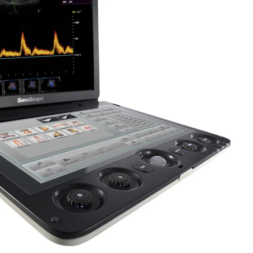 Touch Screen Sonoscape S9V Colour Doppler Veterinary Ultrasound