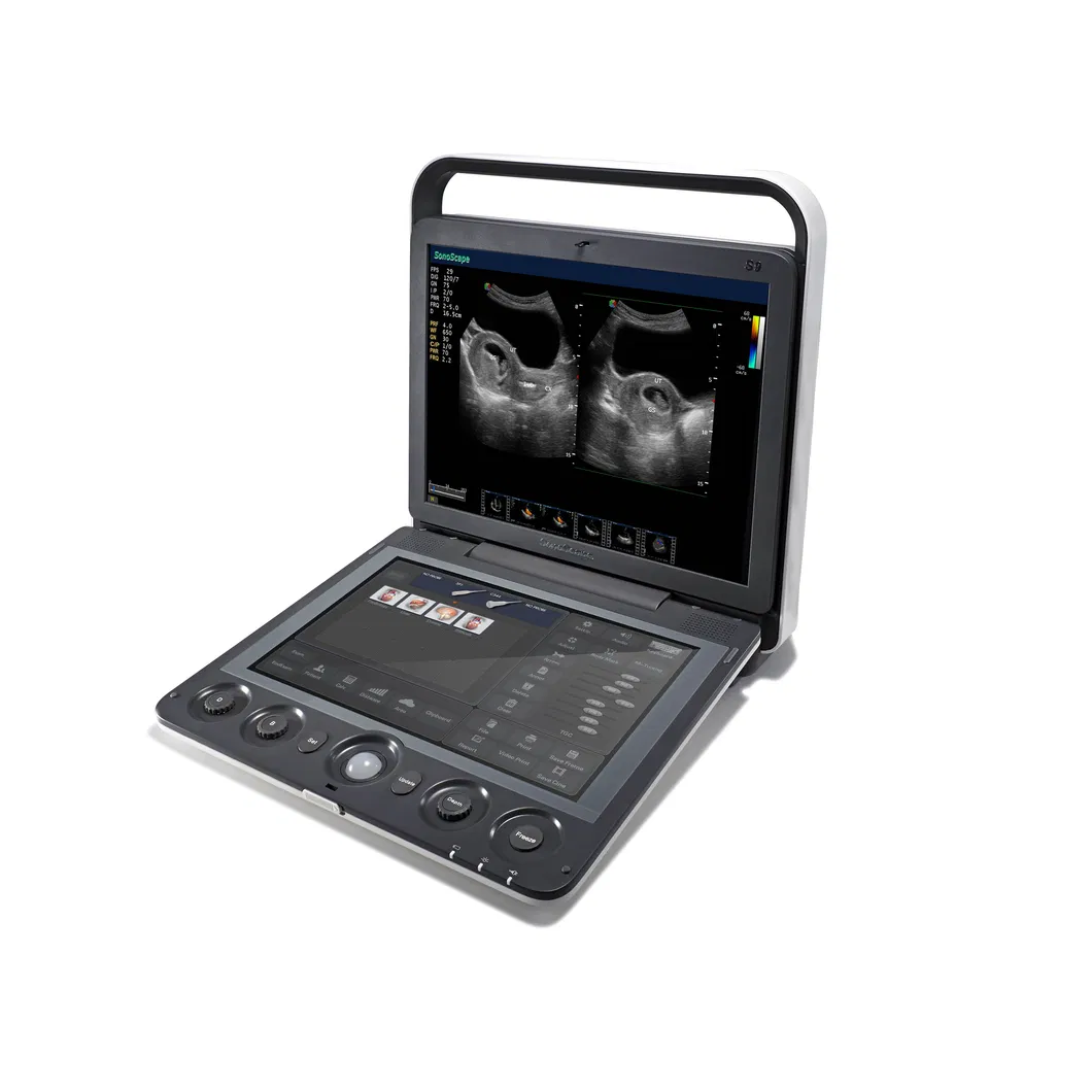 Touch Screen Sonoscape S9V Colour Doppler Veterinary Ultrasound