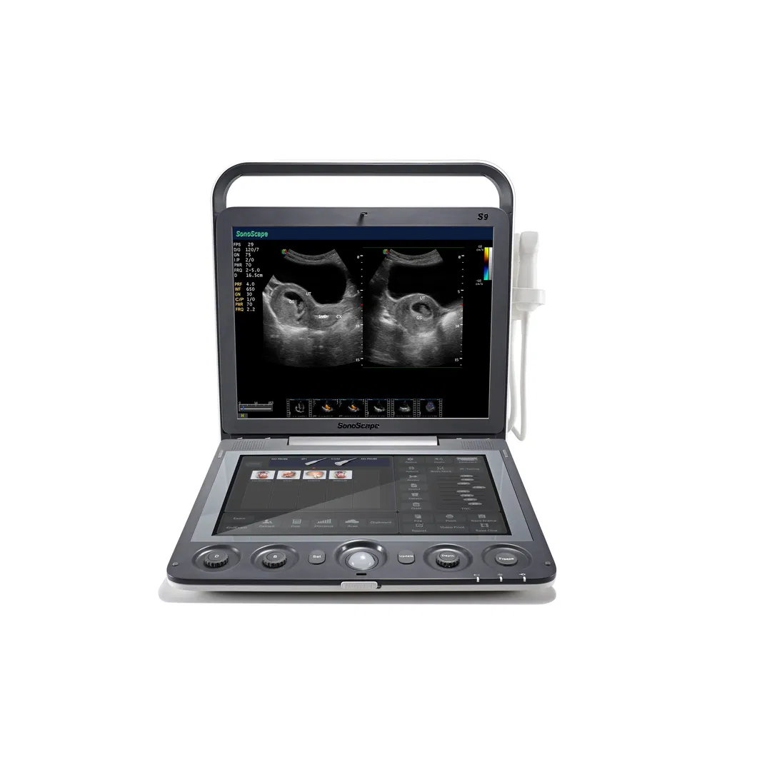 Touch Screen Sonoscape S9V Colour Doppler Veterinary Ultrasound