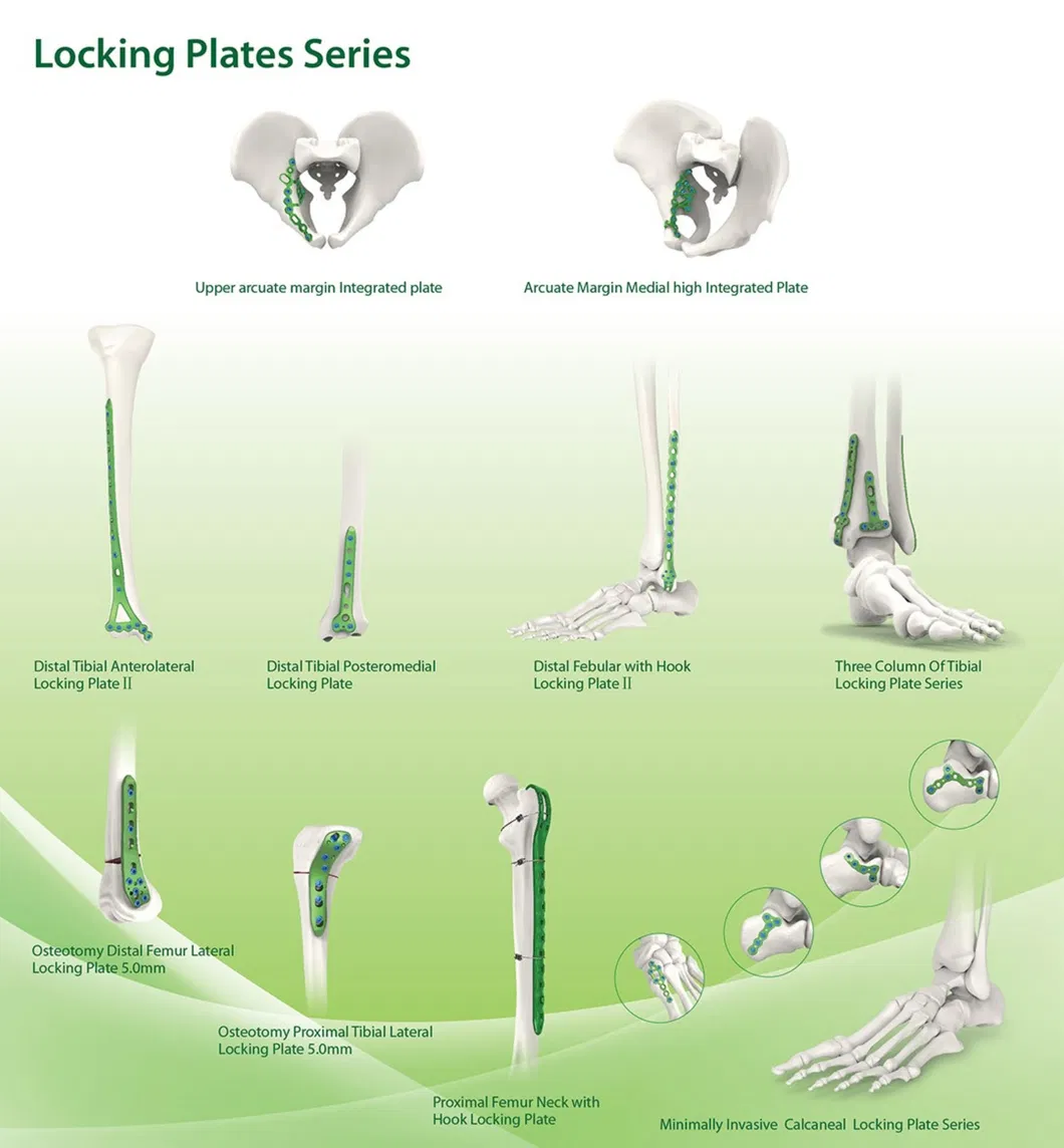 Trauma Bone Plate Distal Clavicle Claw Plate396