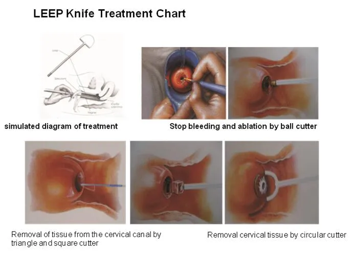 Trolley Electric Leep Knife Surgery Leep Equipment