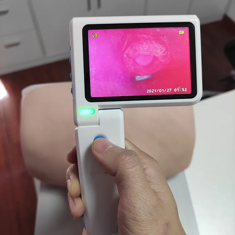 Visual Intubation Emergency Laryngoscope Rapid Intubation with CE FDA Approved