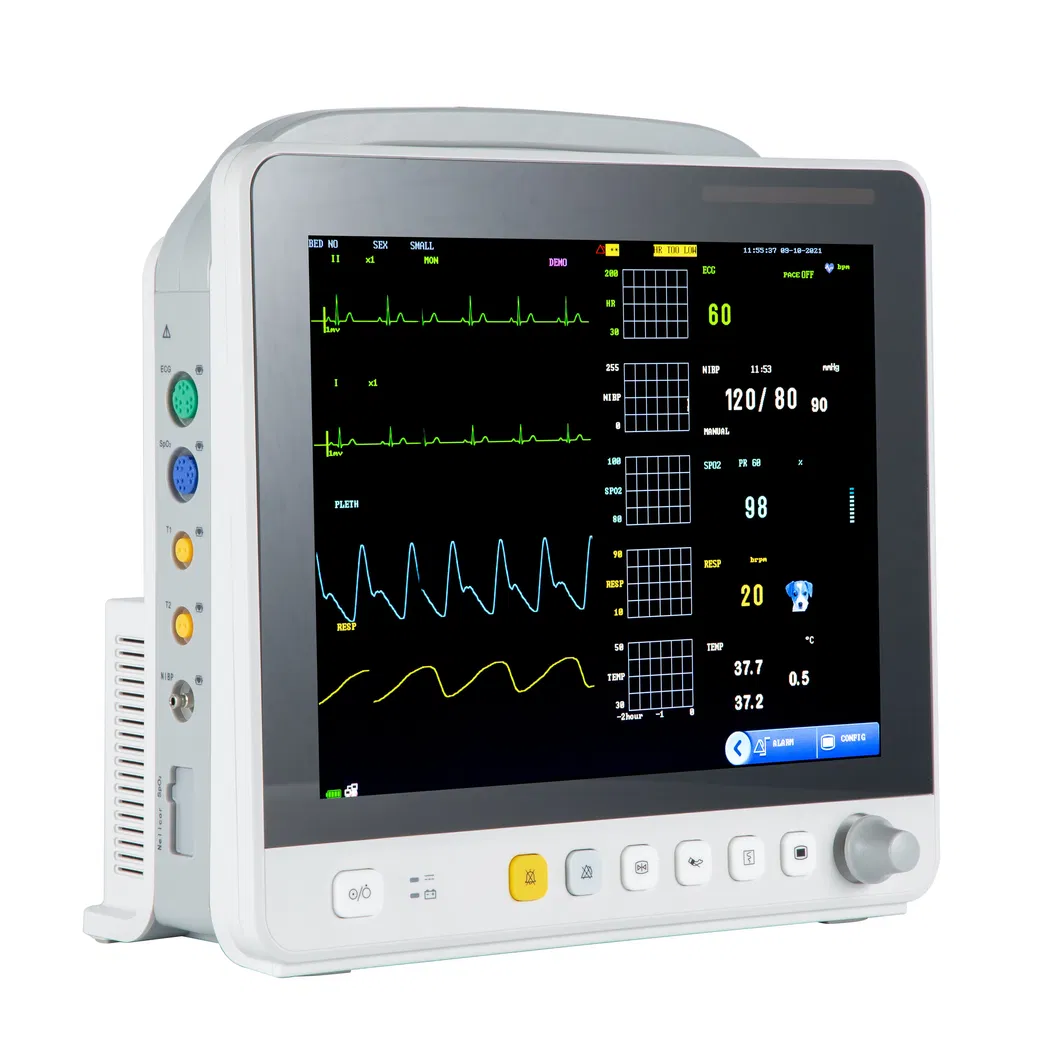 Yonker 12 Inch Multi-Parameter Veterinary Vital Signs Monitor for Pets Clinics and Vet Hosptials with Touch Monitor